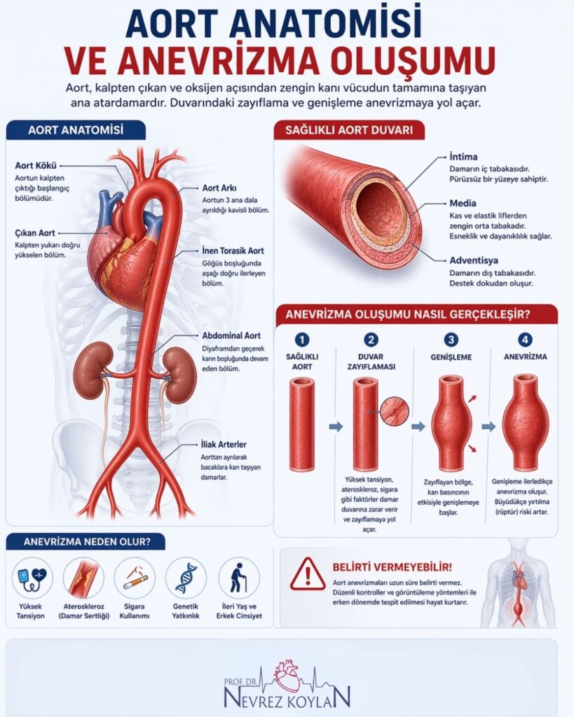 “Aort anatomisi ve anevrizma oluşumu” başlıklı 4:5 oranlı infografik: sol tarafta kalpten başlayıp göğüs ve karın boyunca uzanan aortun anatomik yapısı ve dalları etiketlenmiş; sağ üstte sağlıklı aort duvarının kesiti (intima, media, adventisya katmanları) gösterilmiş. Sağ alt bölümde anevrizma oluşum süreci adım adım görselleştirilmiş (sağlıklı damar → duvar zayıflaması → genişleme → anevrizma). Alt kısımda risk faktörleri (hipertansiyon, ateroskleroz, sigara, genetik, ileri yaş) ve korunma önerileri ikonlarla sunuluyor; genel tasarım kırmızı-mavi tonlarda, temiz ve tıbbi anlatım odaklı.