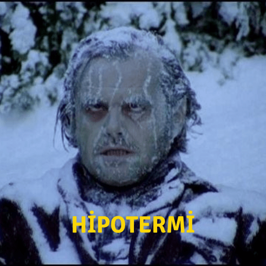 Hipotermi