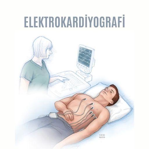 Elektrokardiyografi