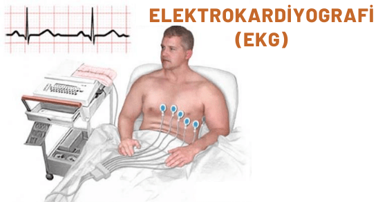 Elektrokardiyografi (EKG)