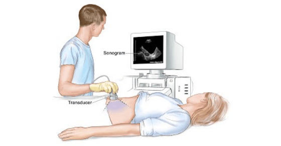 Ultrasonografi uygulanması
