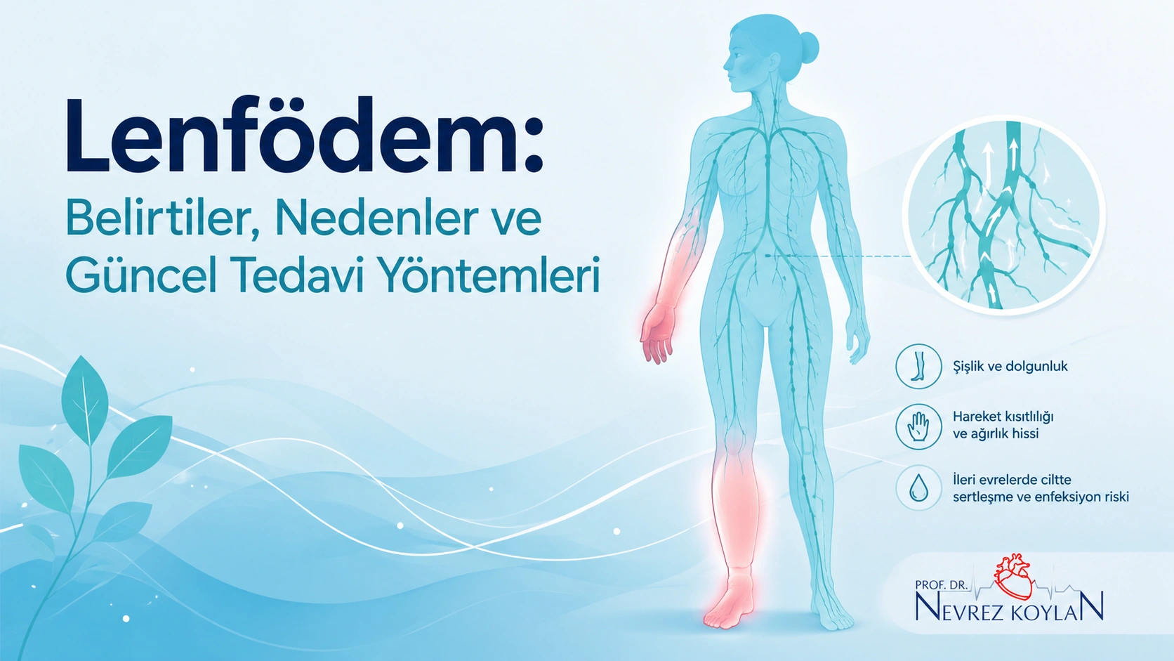 Lenfödem belirtileri, nedenleri ve güncel tedavi yöntemlerini anlatan kapak görseli