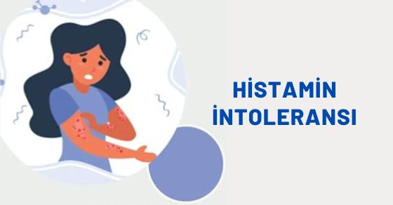 Histamin intoleransı