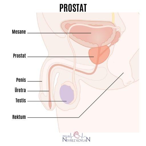 Prostat