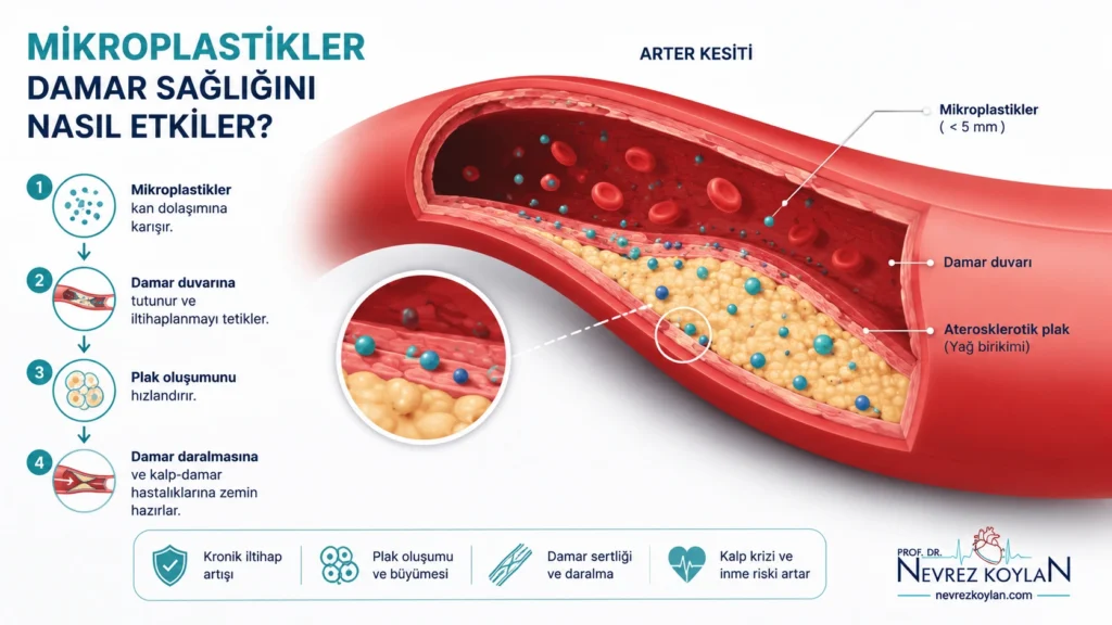Mikroplastiklerin damar duvarındaki plak birikimine etkisini gösteren şematik görsel