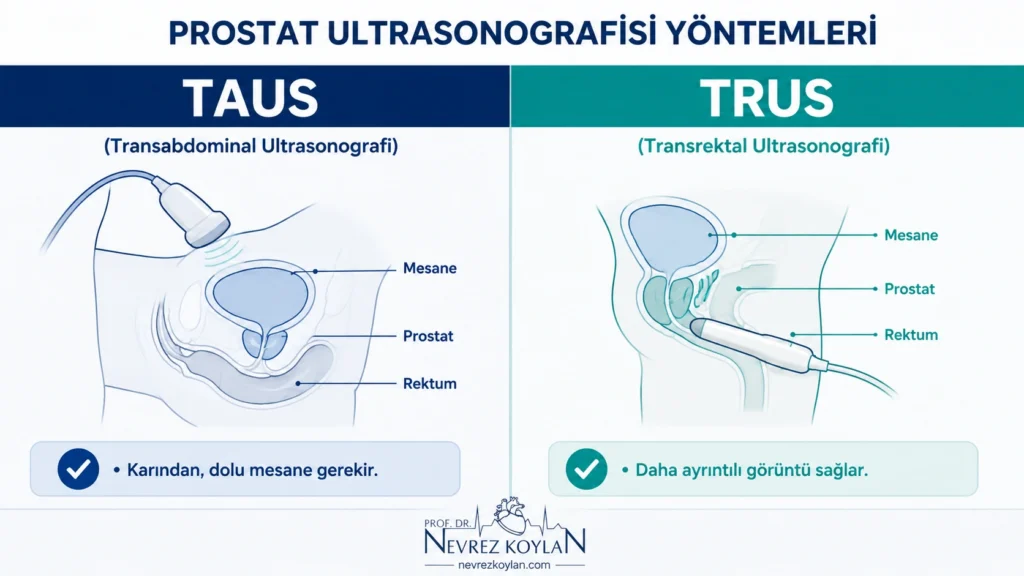 TAUS (transabdominal) ve TRUS (transrektal) prostat ultrasonografi yöntemlerinin karşılaştırmalı şeması