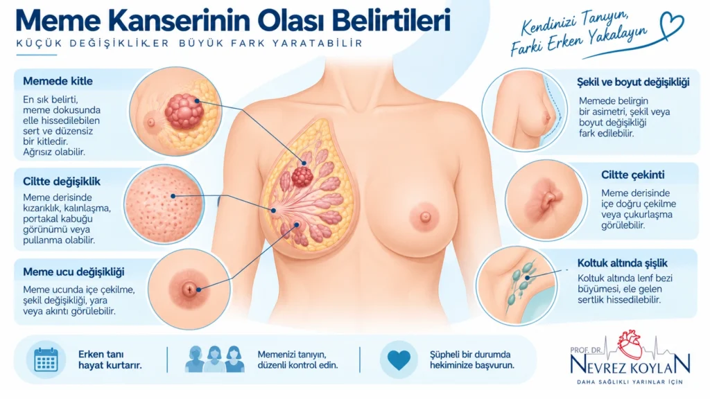 Meme kanserinde dikkat edilmesi gereken belirtileri gösteren bilgilendirici illüstrasyon