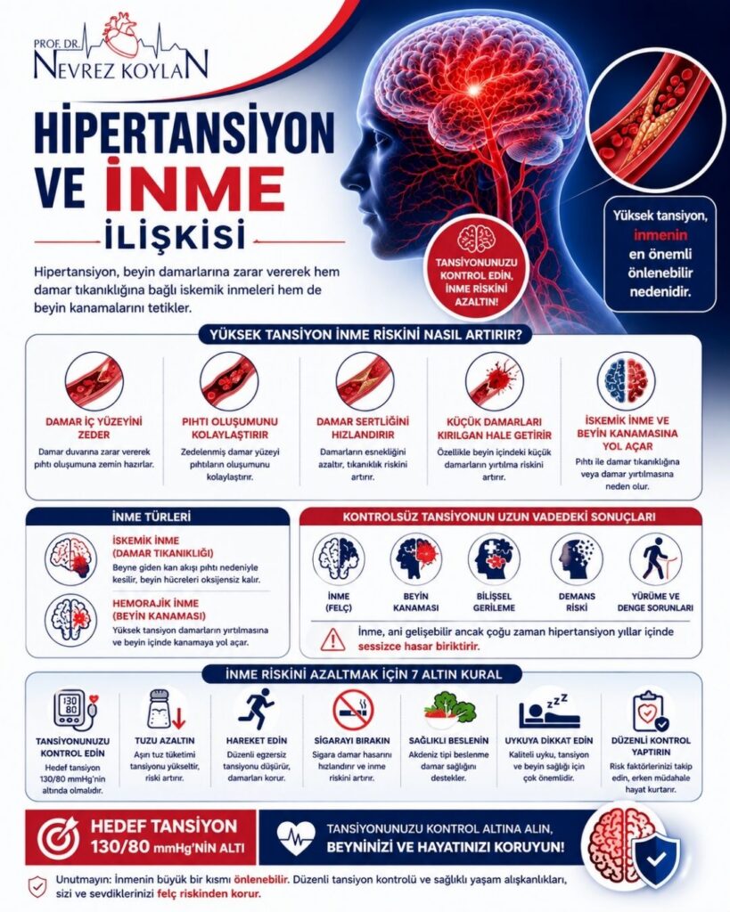 Hipertansiyon ve inme arasındaki ilişkiyi anlatan 4:5 oranlı detaylı medikal infografik. Sol üst köşede Prof. Dr. Nevrez Koylan logosu bulunuyor. Görselin üst bölümünde büyük puntolarla “Hipertansiyon ve İnme İlişkisi” başlığı yer alıyor. Sağ tarafta kırmızı damar ağıyla vurgulanmış anatomik bir beyin illüstrasyonu ve damar içinde plak oluşumunu gösteren damar kesiti görseli bulunuyor. Alt başlıkta hipertansiyonun hem damar tıkanıklığına bağlı iskemik inmeleri hem de beyin kanamalarını tetiklediği anlatılıyor. Orta bölümde hipertansiyonun damar iç yüzeyini zedelemesi, pıhtı oluşumunu kolaylaştırması, damar sertliğini hızlandırması ve küçük damarları kırılgan hale getirmesi ikonlarla açıklanıyor. Görselde ayrıca iskemik inme ve hemorajik inme türleri ayrı bölümlerde özetleniyor. Alt bölümde inme, beyin kanaması, bilişsel gerileme, demans riski ve yürüme-denge sorunları gibi uzun vadeli etkiler ikonlarla gösteriliyor. En altta tansiyon kontrolü, tuzu azaltma, egzersiz, sigarayı bırakma, sağlıklı beslenme, uyku düzeni ve düzenli kontrol önerileri yer alıyor. “Hedef tansiyon 130/80 mmHg’nin altı” mesajı kırmızı vurgulu kutu içinde belirtilmiş. Genel tasarım lacivert, kırmızı ve beyaz tonlarında modern, profesyonel ve bilgilendirici sağlık posteri tarzında hazırlanmış.