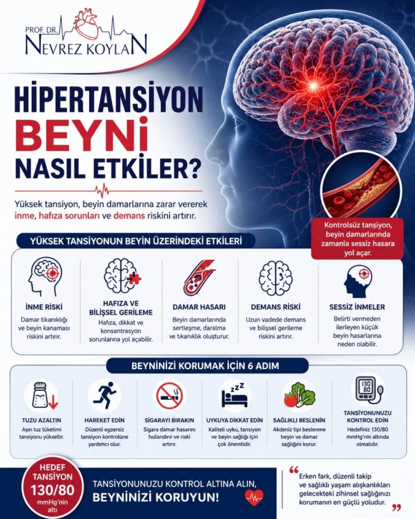 Hipertansiyonun beyin sağlığı üzerindeki etkilerini anlatan 4:5 oranlı detaylı medikal infografik. Sol üst köşede Prof. Dr. Nevrez Koylan logosu bulunuyor. Görselin üst bölümünde büyük puntolarla “Hipertansiyon Beyni Nasıl Etkiler?” başlığı yer alırken sağ tarafta kırmızı damar ağıyla vurgulanmış anatomik bir beyin illüstrasyonu bulunuyor. Alt başlıkta yüksek tansiyonun inme, hafıza sorunları ve demans riskini artırdığı belirtiliyor. Orta bölümde yüksek tansiyonun beyin üzerindeki etkileri; inme riski, hafıza ve bilişsel gerileme, damar hasarı, demans riski ve sessiz inmeler başlıkları altında ikonlarla açıklanıyor. Alt bölümde beyni korumak için tuzu azaltma, egzersiz yapma, sigarayı bırakma, uyku düzenine dikkat etme, sağlıklı beslenme ve tansiyon kontrolü önerileri yer alıyor. Sol alt köşede “Hedef Tansiyon 130/80 mmHg’nin altı” mesajı bulunurken genel tasarım lacivert, kırmızı ve beyaz tonlarında modern ve profesyonel sağlık posteri tarzında hazırlanmış.