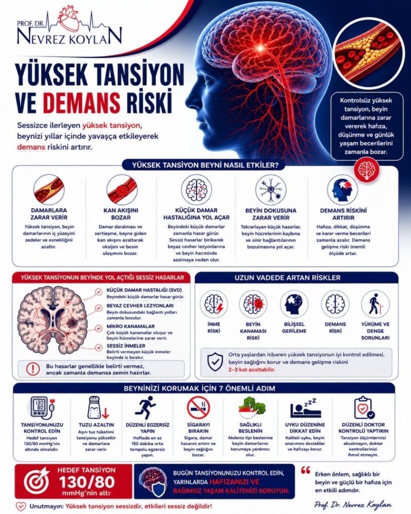 Yüksek tansiyon ve demans riski arasındaki ilişkiyi anlatan 4:5 oranlı detaylı medikal infografik. Sol üst köşede Prof. Dr. Nevrez Koylan logosu bulunuyor. Görselin üst bölümünde büyük puntolarla “Yüksek Tansiyon ve Demans Riski” başlığı yer alıyor. Sağ tarafta kırmızı damar ağıyla vurgulanmış anatomik bir beyin illüstrasyonu ve damar içinde plak birikimini gösteren damar kesiti görseli bulunuyor. Alt başlıkta kontrolsüz yüksek tansiyonun yıllar içinde beyin damarlarına zarar vererek hafıza, düşünme ve günlük yaşam becerilerini bozabileceği belirtiliyor. Orta bölümde hipertansiyonun damarlara zarar vermesi, kan akışını bozması, küçük damar hastalığına yol açması, beyin dokusuna zarar vermesi ve demans riskini artırması ikonlarla açıklanıyor. Sol alt bölümde küçük damar hastalığı, beyaz cevher lezyonları, mikro kanamalar ve sessiz inmeleri gösteren beyin kesiti illüstrasyonu yer alıyor. Sağ alt bölümde inme riski, beyin kanaması, bilişsel gerileme, demans riski ve yürüme-denge sorunları gibi uzun vadeli etkiler ikonlarla anlatılıyor. En alt bölümde tansiyon kontrolü, tuzu azaltma, düzenli egzersiz, sigarayı bırakma, sağlıklı beslenme, uyku düzeni ve düzenli doktor kontrolü gibi koruyucu öneriler bulunuyor. Kırmızı kutu içinde “Hedef tansiyon 130/80 mmHg’nin altı” mesajı vurgulanmış. Genel tasarım lacivert, kırmızı ve beyaz tonlarında modern, profesyonel ve bilgilendirici sağlık posteri tarzında hazırlanmış.