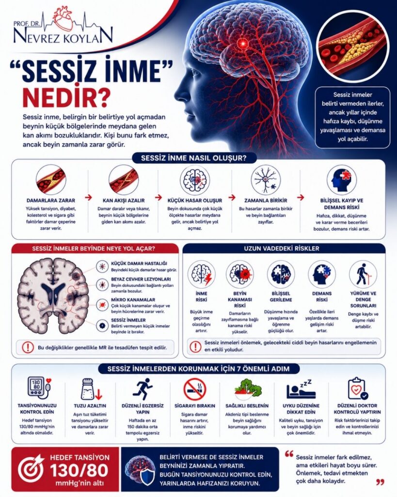 Yüksek tansiyon ve demans riski arasındaki ilişkiyi anlatan 4:5 oranlı detaylı medikal infografik. Sol üst köşede Prof. Dr. Nevrez Koylan logosu yer alıyor. Görselin üst bölümünde büyük puntolarla “Yüksek Tansiyon ve Demans Riski” başlığı bulunuyor. Sağ tarafta kırmızı damar ağıyla vurgulanmış anatomik bir beyin illüstrasyonu ve damar içinde plak oluşumunu gösteren damar kesiti görseli yer alıyor. Alt açıklamada kontrolsüz yüksek tansiyonun yıllar içinde beyin damarlarına zarar vererek hafıza, düşünme ve günlük yaşam becerilerini bozabileceği belirtiliyor. Orta bölümde hipertansiyonun damarlara zarar vermesi, kan akışını bozması, küçük damar hastalığına yol açması, beyin dokusuna zarar vermesi ve demans riskini artırması ikonlarla açıklanıyor. Sol orta bölümde küçük damar hastalığı, beyaz cevher lezyonları, mikro kanamalar ve sessiz inmeleri gösteren beyin kesiti illüstrasyonu bulunuyor. Sağ orta bölümde inme riski, beyin kanaması, bilişsel gerileme, demans riski ve yürüme-denge sorunları gibi uzun vadeli etkiler ikonlarla anlatılıyor. Alt bölümde tansiyon kontrolü, tuzu azaltma, düzenli egzersiz, sigarayı bırakma, sağlıklı beslenme, uyku düzeni ve düzenli doktor kontrolü gibi koruyucu öneriler ikonlarla sıralanıyor. En altta kırmızı kutu içinde “Hedef tansiyon 130/80 mmHg’nin altı” mesajı vurgulanmış. Genel tasarım lacivert, kırmızı ve beyaz tonlarında modern, profesyonel ve bilgilendirici sağlık posteri tarzında hazırlanmış.