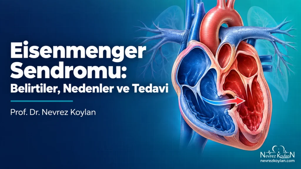 Eisenmenger sendromu: belirtiler, nedenler ve tedavi – kalpte ters yönlü kan akışını gösteren illüstrasyon