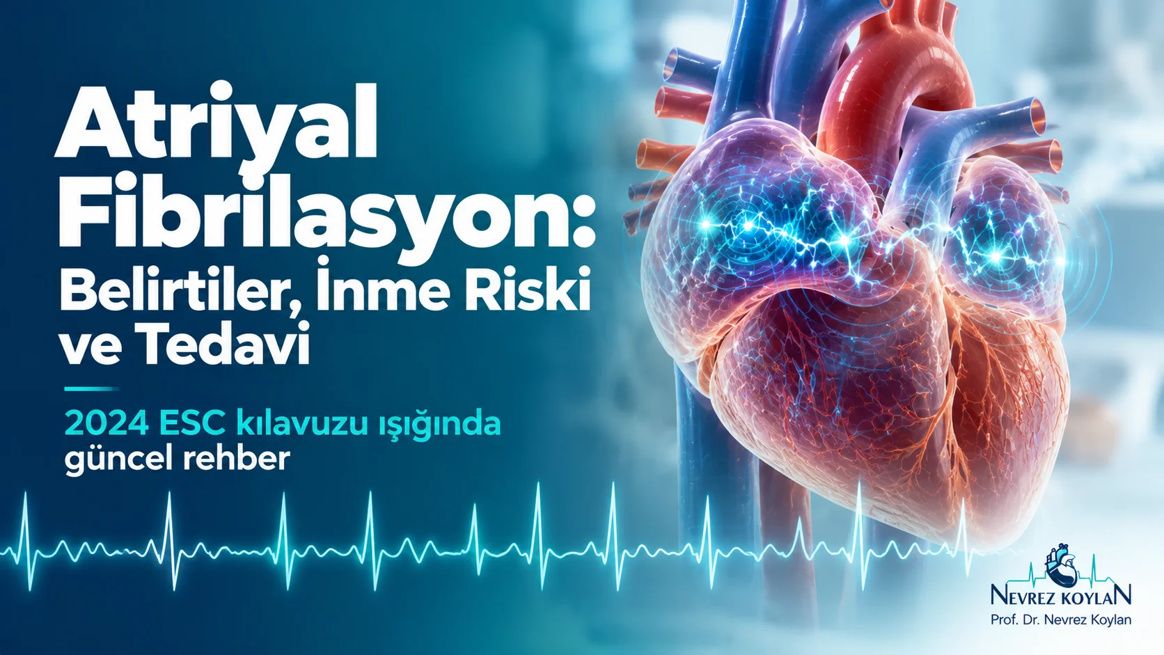 Atriyal fibrilasyon kapak görseli: kulakçıklarında düzensiz elektrik dalgaları olan 3D kalp modeli, düzensiz EKG çizgisi ve "Atriyal Fibrilasyon: Belirtiler, İnme Riski ve Tedavi" başlığı, Prof. Dr. Nevrez Koylan logosu