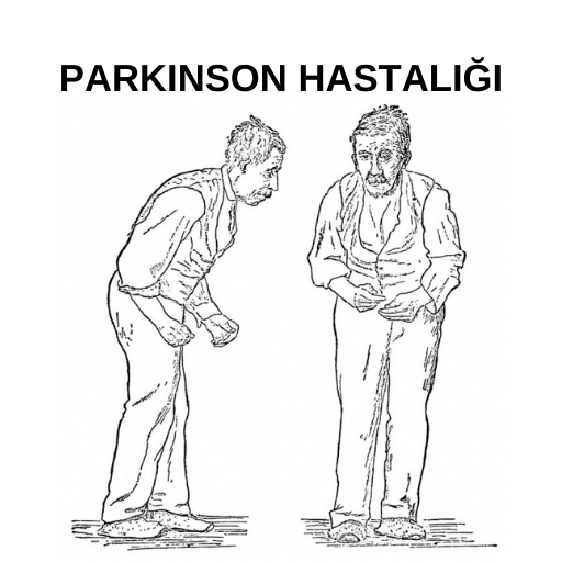 Parkinson hastalığı