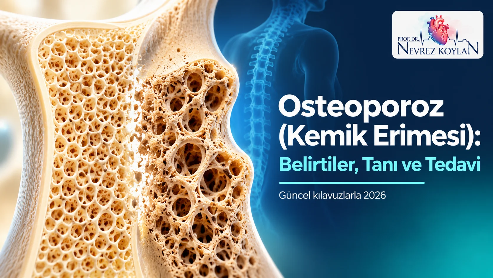 Osteoporoz (kemik erimesi) kapak görseli: sağlıklı ve gözenekli kemik dokusunun karşılaştırması, Prof. Dr. Nevrez Koylan logosu