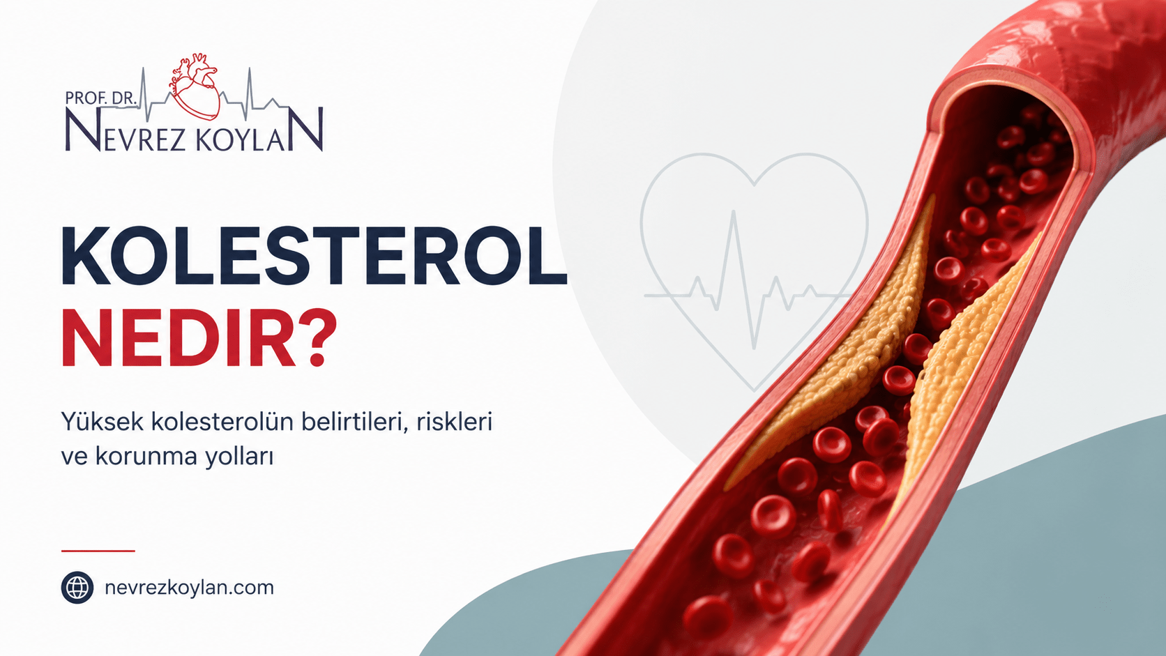 Kolesterol nedir başlıklı, damar içinde plak birikimini gösteren Prof. Dr. Nevrez Koylan blog kapak görseli.