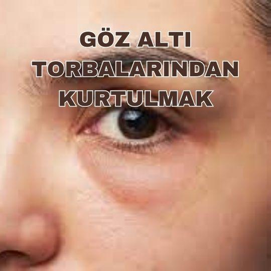 Göz altı torbalarından kurtulmak