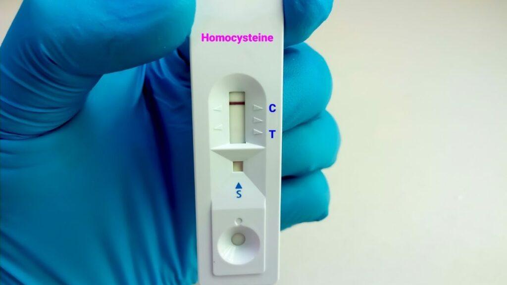 Yüksek homosistein ve sağlık