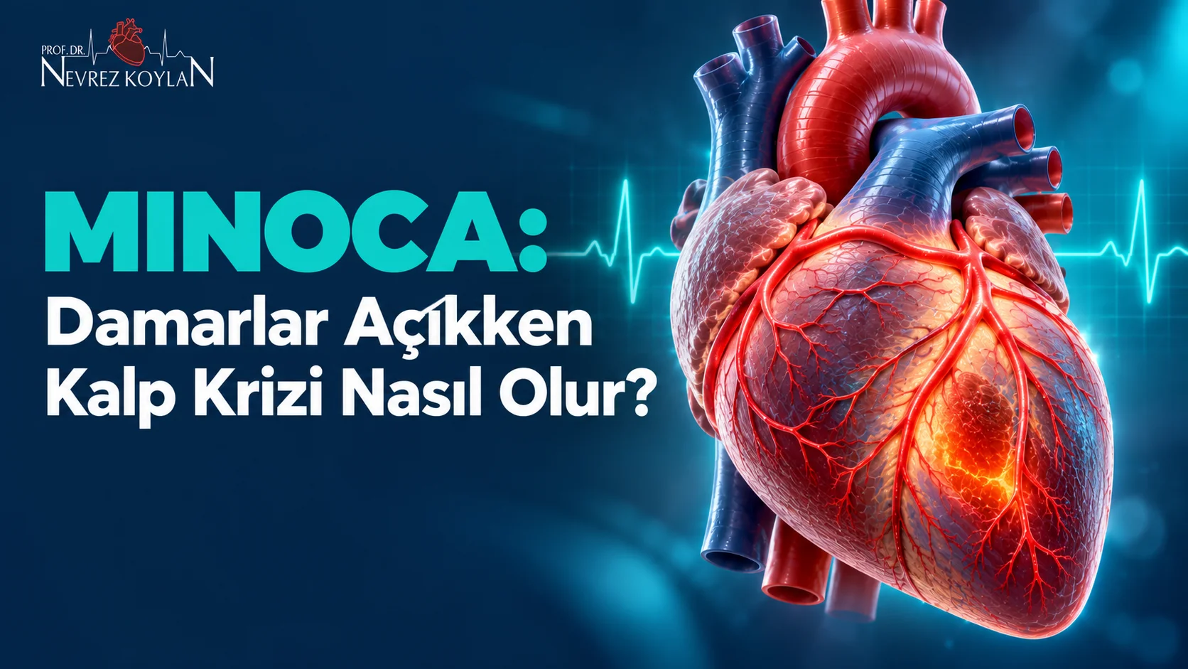 MINOCA: Damarlar açıkken kalp krizi nasıl olur başlıklı kapak; açık koroner damarlı parlayan anatomik kalp ve Prof. Dr. Nevrez Koylan logosu