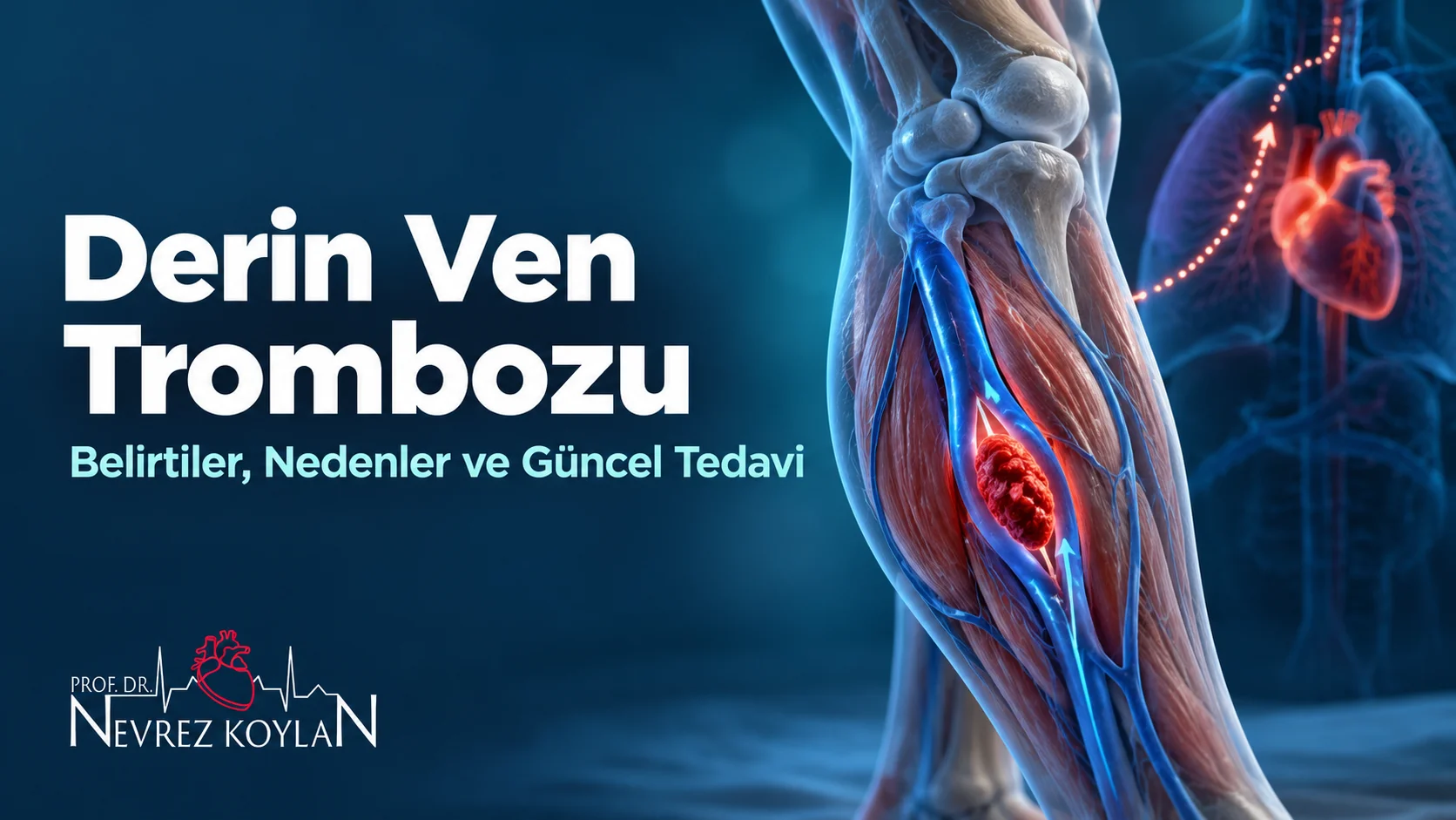 Derin ven trombozu: belirtiler, nedenler ve güncel tedavi başlıklı kapak; baldırın derin toplardamarında parlayan kırmızı pıhtı, yanda anatomik kalp ve Prof. Dr. Nevrez Koylan logosu