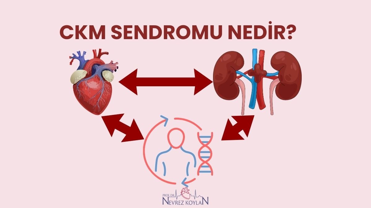 CKM sendromu nedir