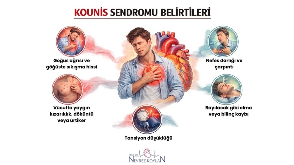 Kounis sendromu belirtileri