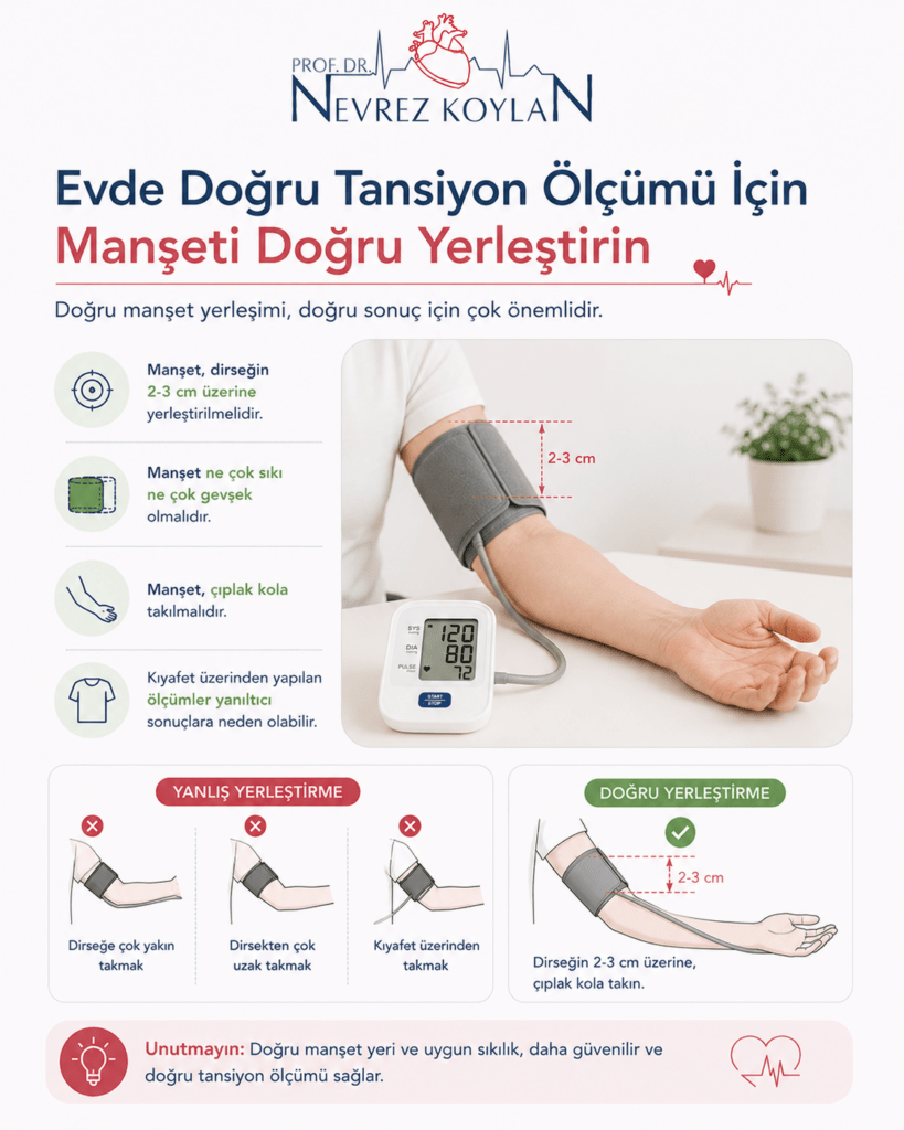 Minimalist tasarımlı sağlık infografiğinde üst bölümde Prof. Dr. Nevrez Koylan logosu ve “Evde Doğru Tansiyon Ölçümü İçin Manşeti Doğru Yerleştirin” başlığı yer alıyor. Görselin sağ tarafında üst kola doğru şekilde yerleştirilmiş tansiyon manşeti bulunan bir kol ve dijital tansiyon cihazı görülüyor. Manşetin dirseğin yaklaşık 2-3 santimetre üzerine takılması gerektiği kırmızı ölçüm çizgileriyle gösteriliyor. Sol tarafta ikon destekli açıklamalar bulunuyor: manşetin çok sıkı veya çok gevşek olmaması, çıplak kola takılması ve kıyafet üzerinden ölçüm yapılmaması gerektiği anlatılıyor. Alt bölümde yanlış manşet yerleşimi örnekleri ile doğru yerleşim karşılaştırmalı olarak gösteriliyor. Açık renkli, sade ve modern sağlık temalı bilgilendirme görseli.
