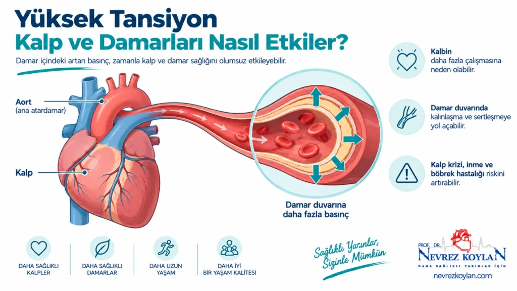 Fazla sodyumun kalp ve damarlar üzerindeki etkisini gösteren basit illüstrasyon